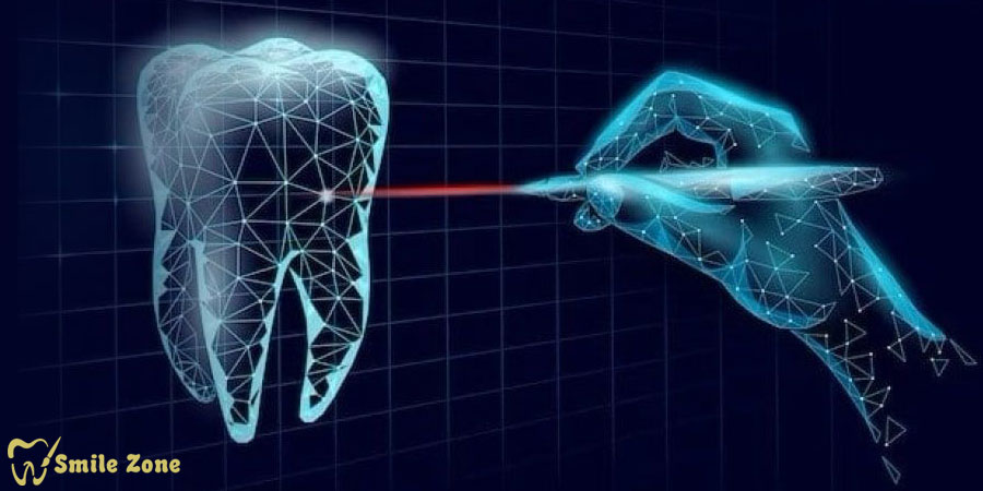قدرت هوش مصنوعی برای پیش‌بینی و پیشگیری از پوسیدگی دندان